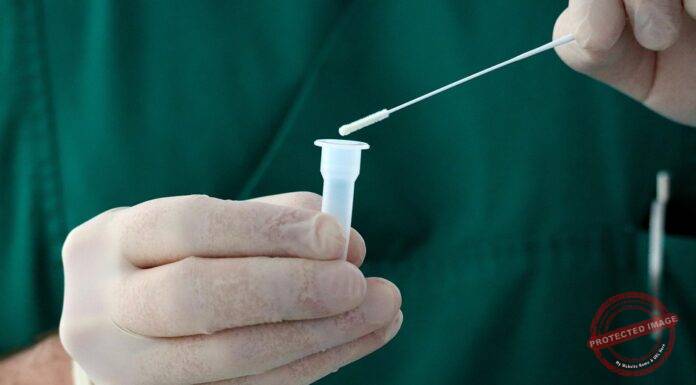 Covid patient dies in Ambedkarnagar, 1498 positive cases present in UP