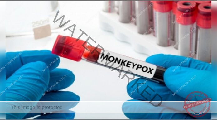 Second case of Mpox found in Kerala, third in country